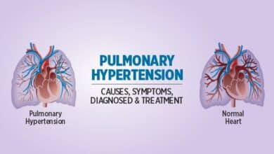Pulmonary Hypertension