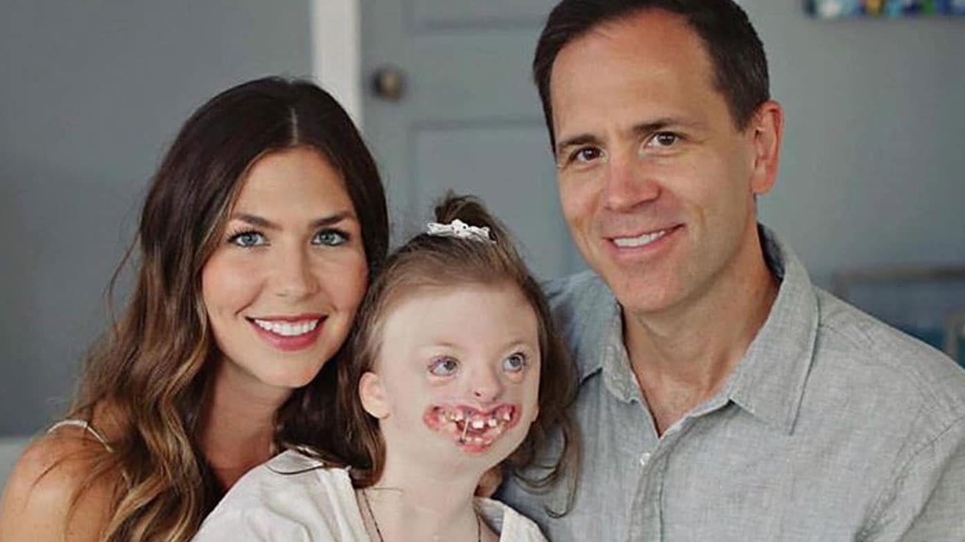 Rett Syndrome
