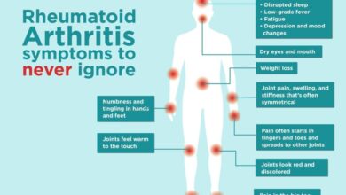 Rheumatoid Arthritis