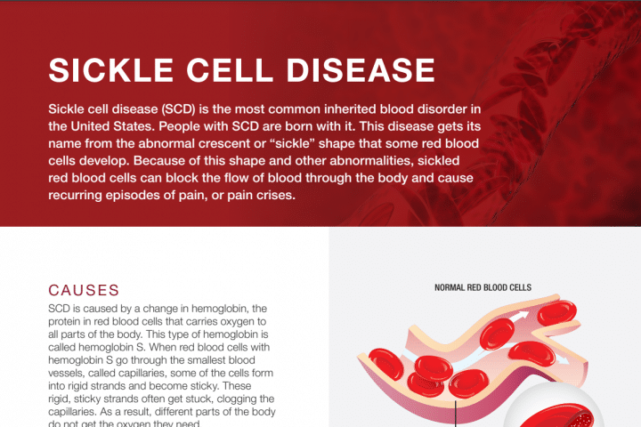 Sickle Cell Disease