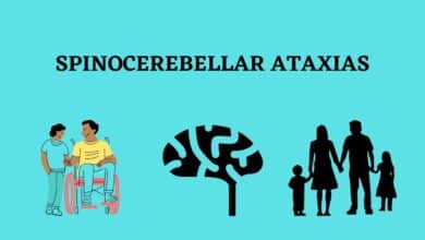 Spinocerebellar Ataxia