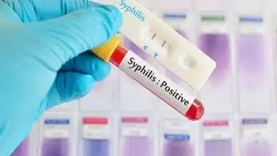 Syphilis cases in expectant mothers have dramatically risen since the pandemic – here’s what’s driving the trend