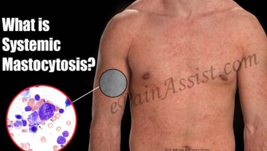 Systemic Mastocytosis