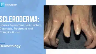 Systemic Sclerosis (Scleroderma)