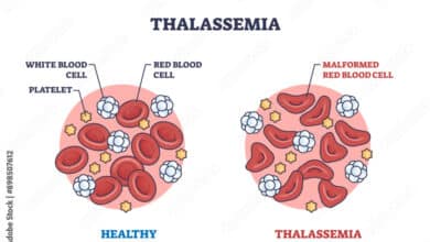 Thalassemia