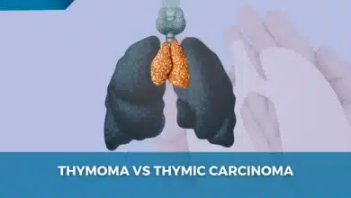 Thymoma and Thymic Carcinoma