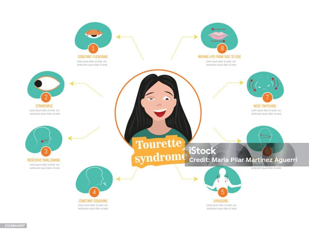 tourette-syndrome-separating-fact-from-pop-culture-myths-observer-voice