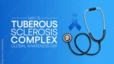 Tuberous Sclerosis Complex