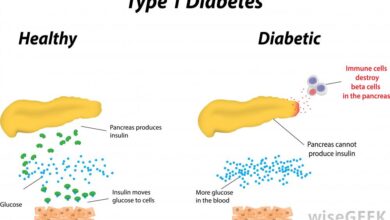 Type 1 Diabetes
