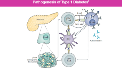 Type 1 Diabetes