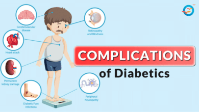 Type 2 Diabetes Complications