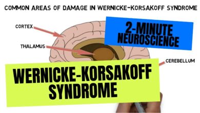 Wernicke-Korsakoff Syndrome