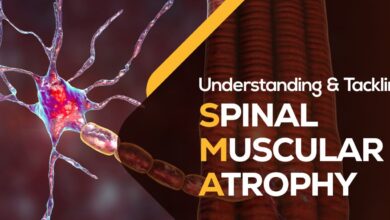 Spinal Muscular Atrophy (SMA)