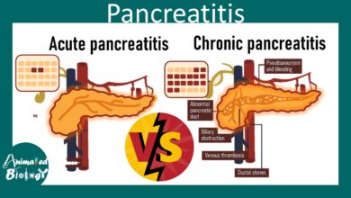 Acute Pancreatitis vs Chronic Pancreatitis