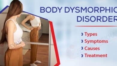 Body Dysmorphic Disorder