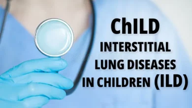 Childhood Interstitial Lung Disease