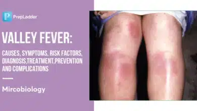 Coccidioidomycosis (Valley Fever)
