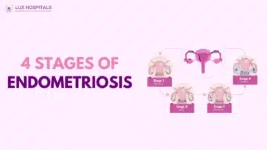 Endometriosis