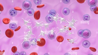 Essential Thrombocythemia