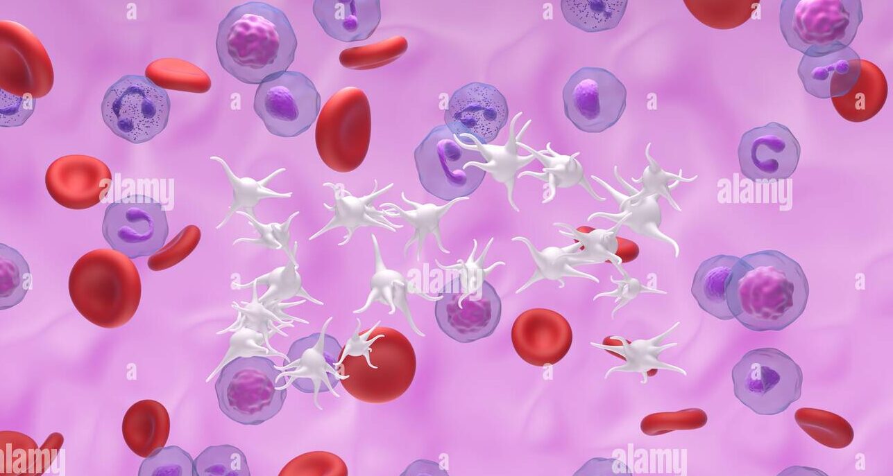 Essential Thrombocythemia