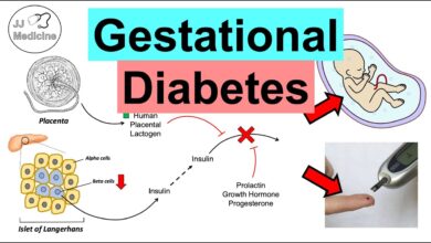 Gestational Diabetes