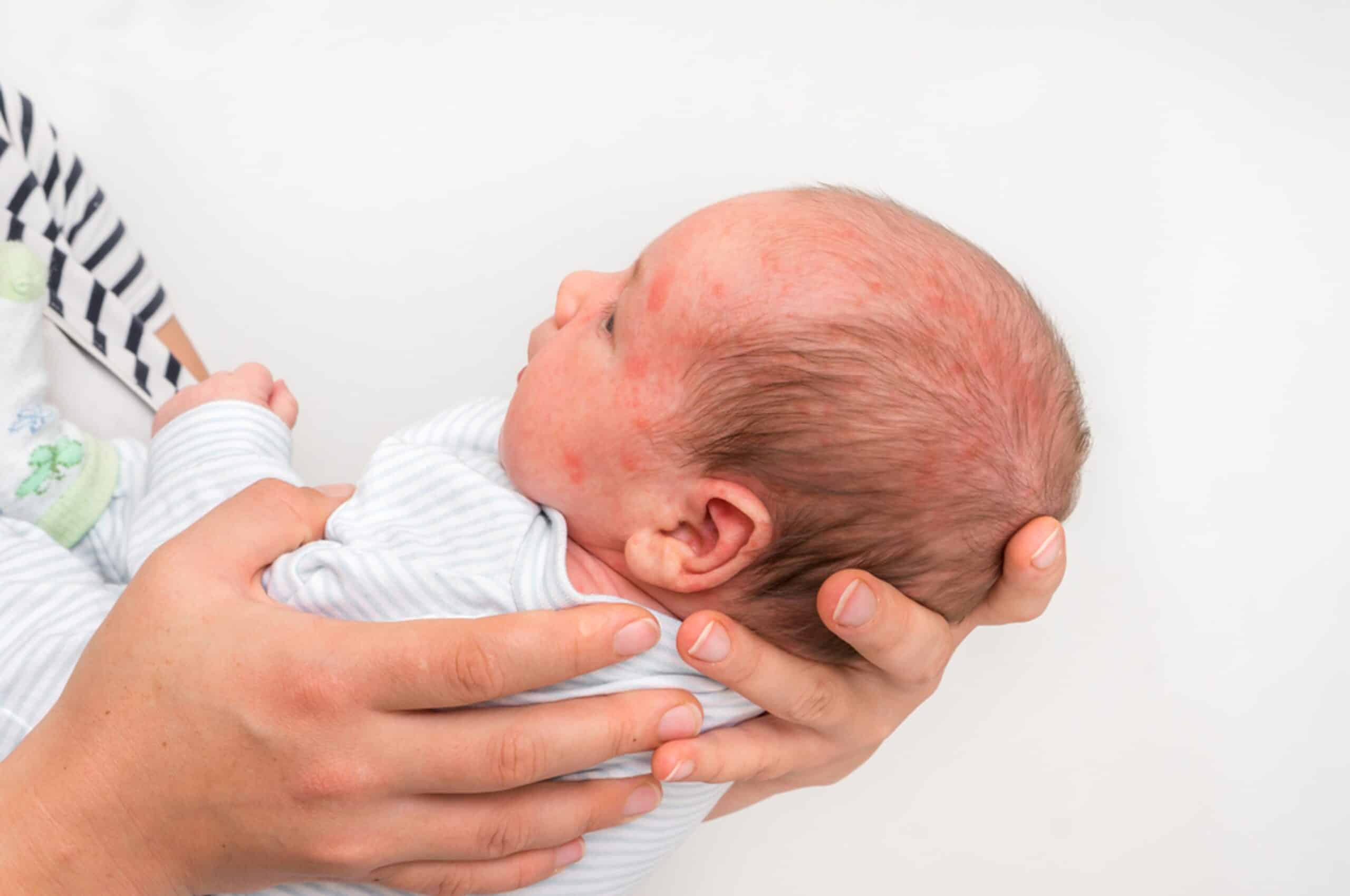 Delayed C-Sections