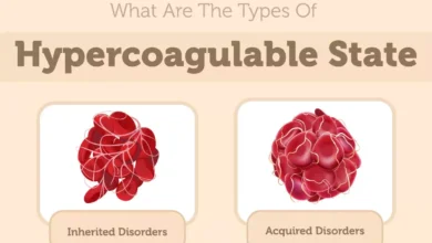 Hypercoagulable States