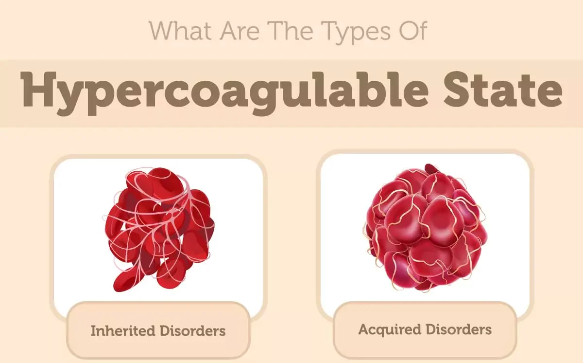 Hypercoagulable States