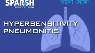Hypersensitivity Pneumonitis