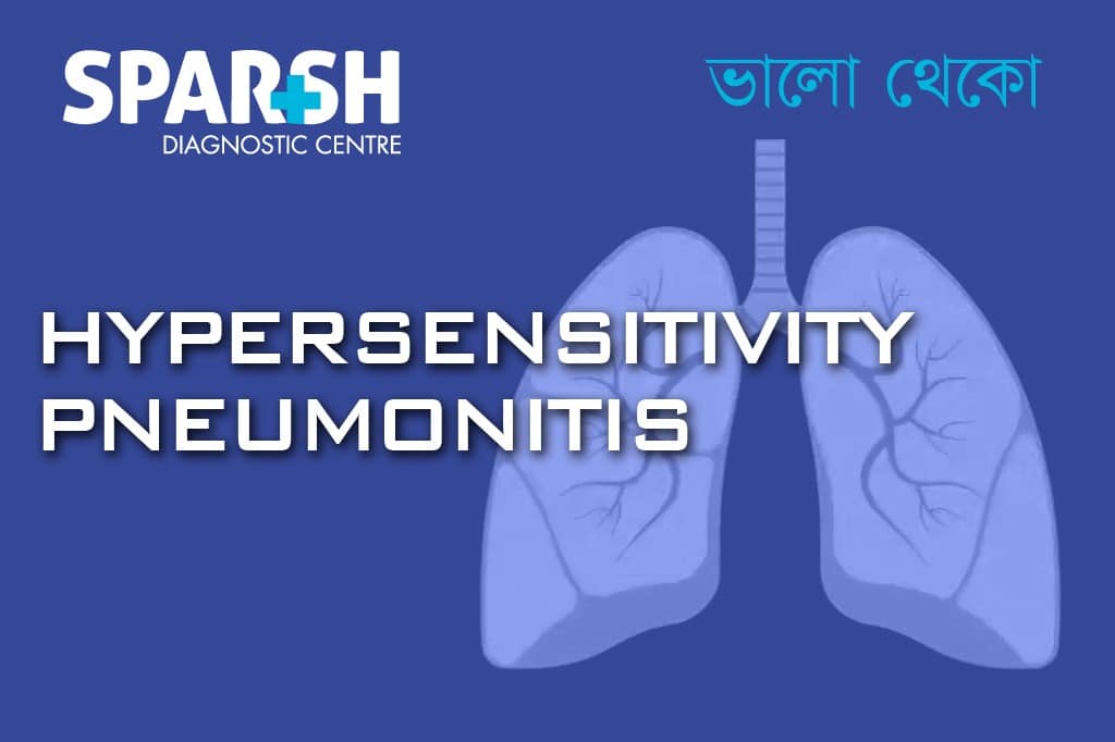 Hypersensitivity Pneumonitis