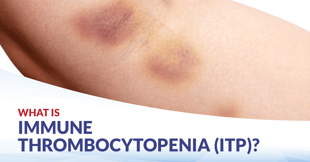 Idiopathic Thrombocytopenic Purpura