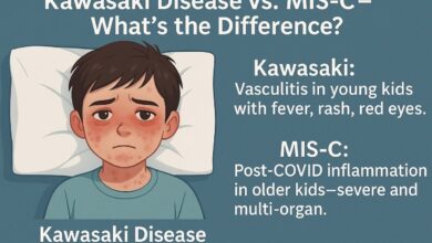 Kawasaki Disease vs MIS-C