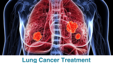 Lung Cancer