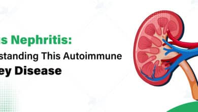 Lupus Nephritis