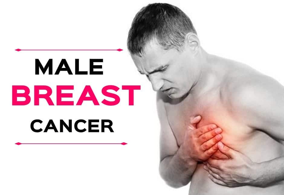 Male Breast Cancer