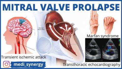 Mitral Valve Prolapse