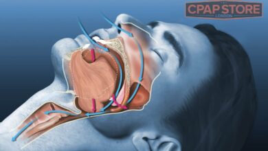 Obstructive Sleep Apnea and ENT
