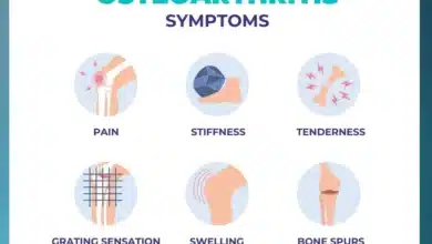 Osteoarthritis