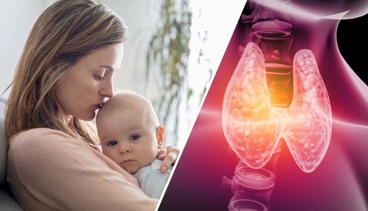 Postpartum Thyroiditis
