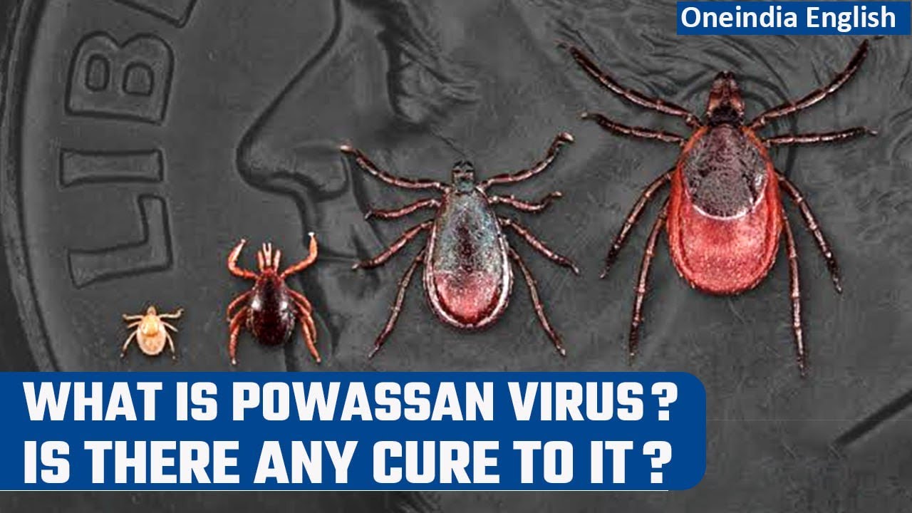 Powassan Virus