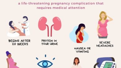 Preeclampsia