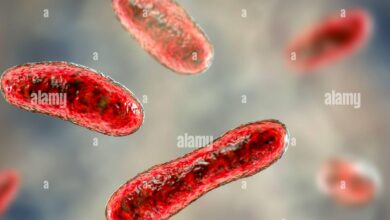 Q Fever (Coxiella burnetii)