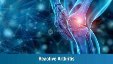 Reactive Arthritis