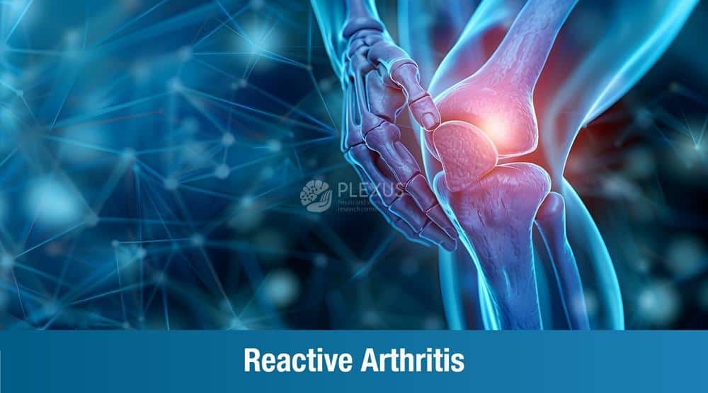 Reactive Arthritis
