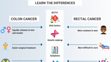 Rectal Cancer vs Colon Cancer
