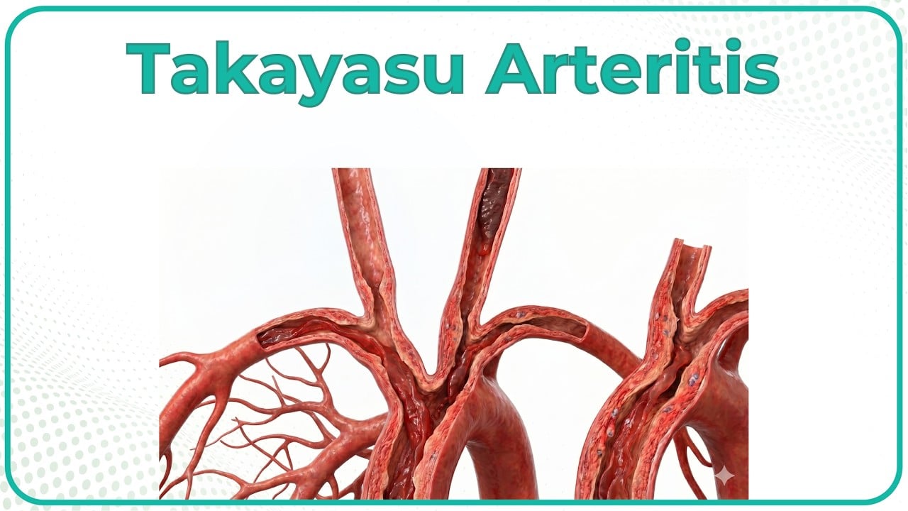 Takayasu Arteritis