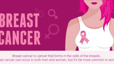 Triple-Negative Breast Cancer