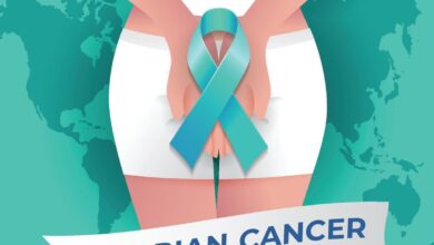 Ovarian Cancer