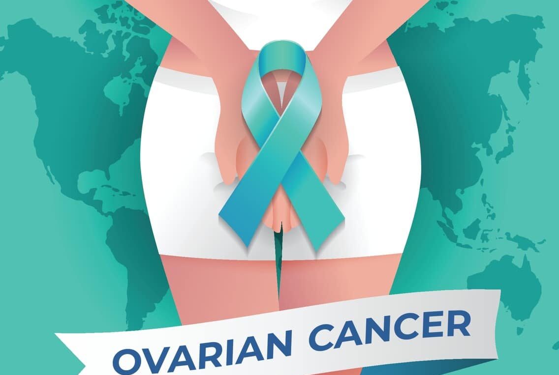 Ovarian Cancer