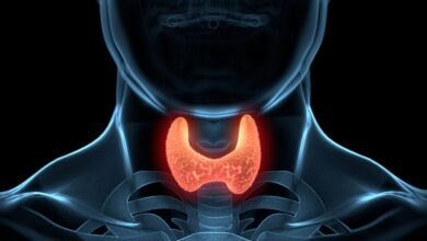 Thyroid Cance